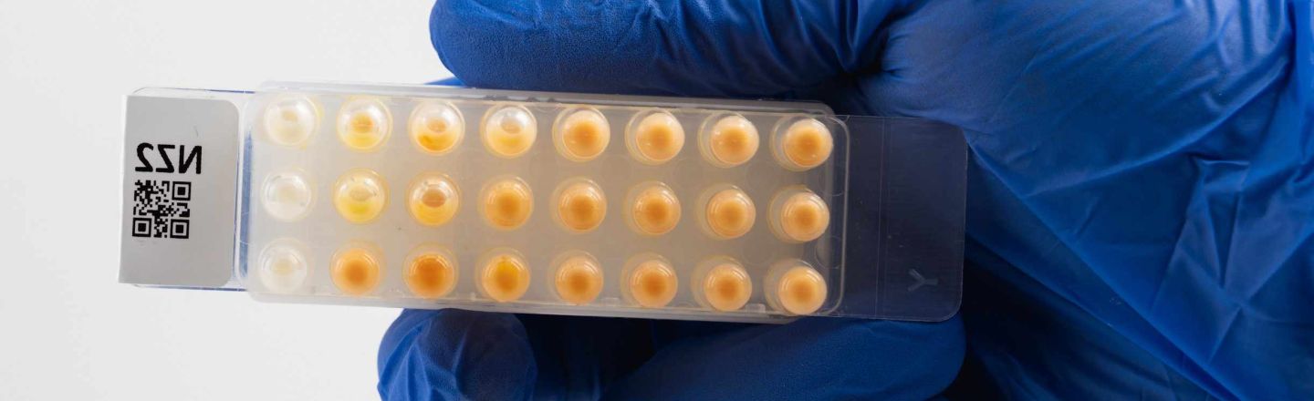 Global antibiotic resistance is rising sharply — including in bacteria shared between animals and humans. Targeted diagnostics are key to protecting antibiotic effectiveness.